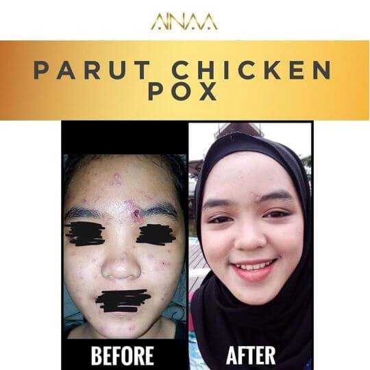 testimoni ainaa serum (2)