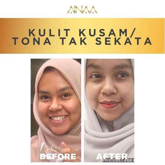 testimoni ainaa serum (3)