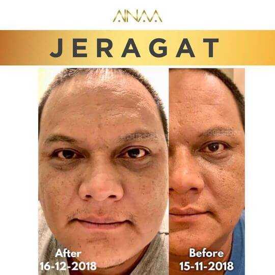 testimoni ainaa serum (7)