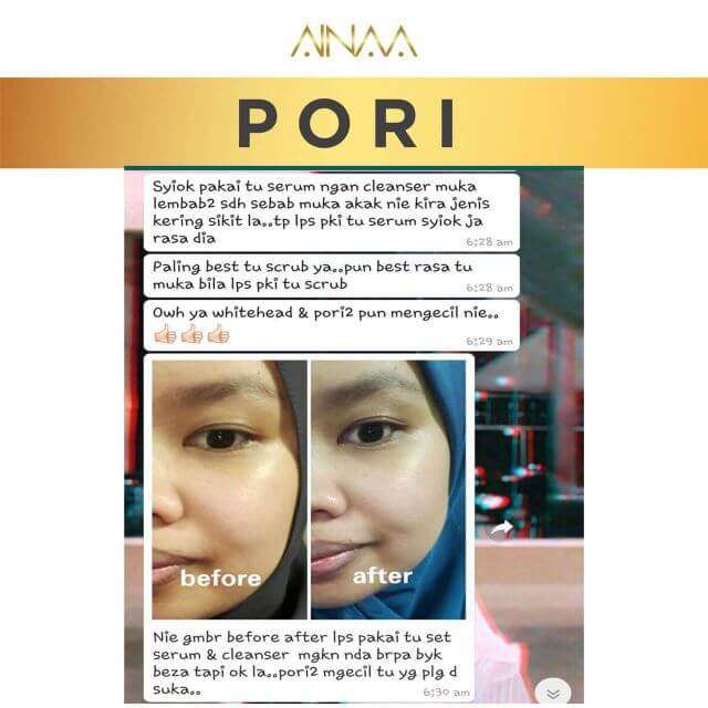 testimoni ainaa serum (8)